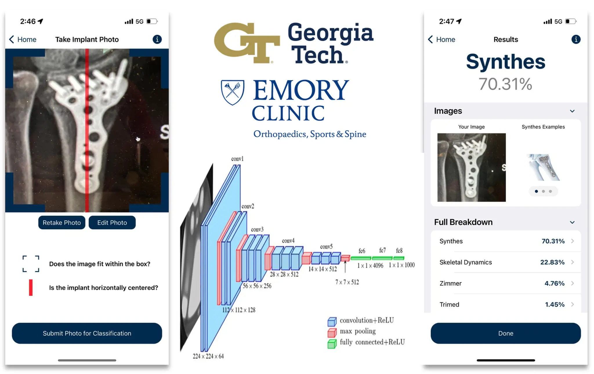 Distal Radius Object Identification (DROiD)